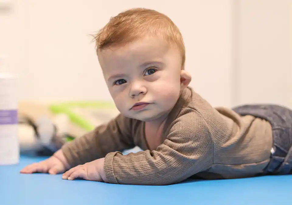 Obrna tvárového nervu